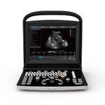 Портативный черно-белый УЗ сканер Chison ECO3, фото, цена