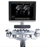 Стационарный УЗИ сканер Chison Qbit 7, фото, цена