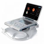 Портативный УЗИ сканер MyLab Alpha